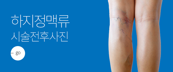 �������Ʒ� �ü����Ļ���